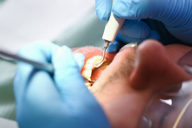 Emergency Dentist Open Today in OK