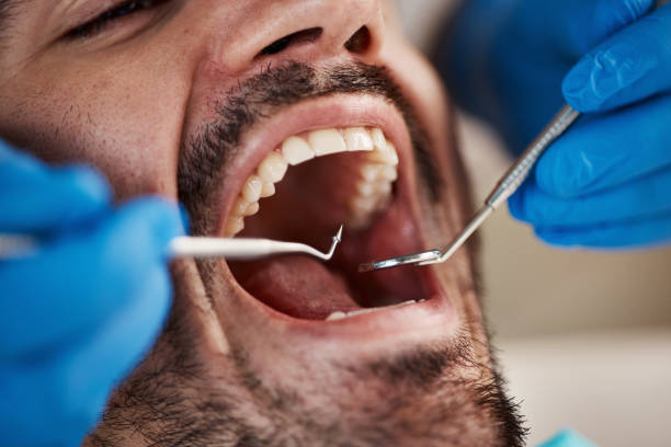 Best Teeth Whitening  in West Siloam Springs, OK